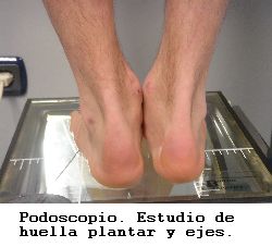 pie huella plantar podoscopio