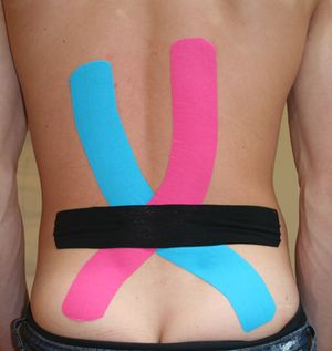 VNM-Kinesiotape Lumbar con Rotación