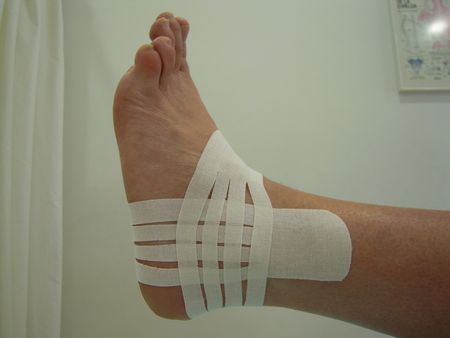 Tobillo: Técnica Ligamentosa con Corte Linfático