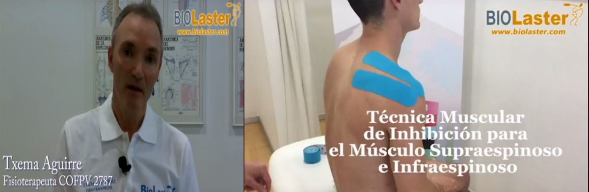 Video: Técnica muscular de Inhibición para Supra e Infraespinoso