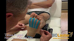 Fascitis plantar: Técnica combinada