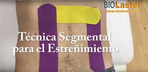 Técnica segmental para estreñimiento