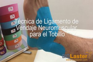 Técnica de ligamento para tobillo