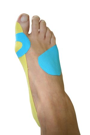 Técnica mixta para Hallux Valgus