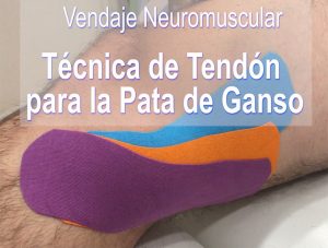 Técnica de tendón para Pata de Ganso