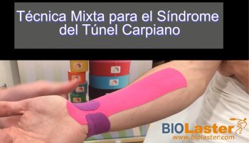 Sindrome del túnel carpiano: Aplicación de vendaje neuromuscular.