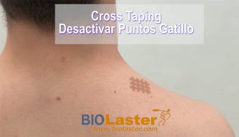 Desactivar puntos gatillo con Cross Tape