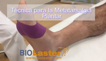 Metatarsalgia con Vendaje Neuromuscular