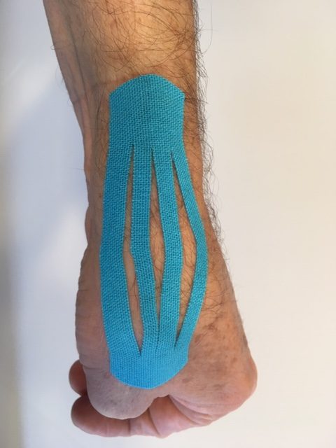 Aries Equipos de Rehabilitación - Ferula para rizartrosis del dedo pulgar  rizartrosis o artrosis de la articulación trapeciometacarpiana del dedo  pulgar, es una de las patologías degenerativas más frecuentes que afectan a