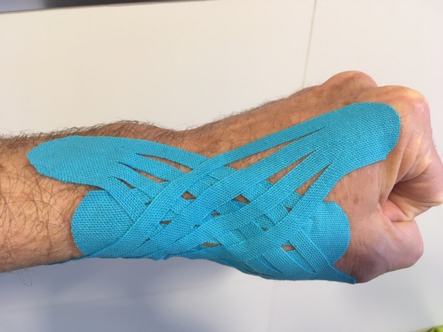 Rizartrosis con kinesiotaping