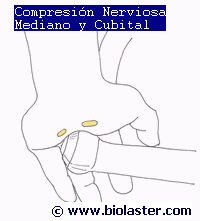 compresion nervio cubital mediano mano ciclismo