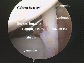 Cirugia de Hombro. Plazos de Recuperacion.