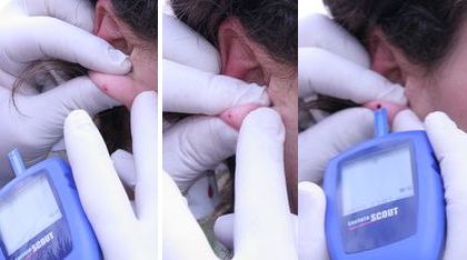 Guía visual de la toma de sangre y análisis de lactato