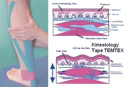 Curso de Vendaje Neuromuscular