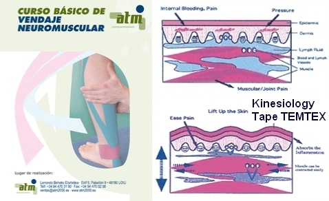 Curso de Vendaje Neuromuscular en Bilbao