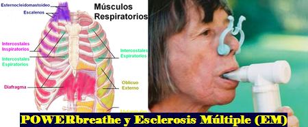 Esclerosis Multiple y Respiracion: Disfuncion Pulmonar, Control y Tratamiento en la Esclerosis Multiple
