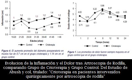 La Crioterapia, una efectiva modalidad de Disminuir la Temperatura Intraarticular, el Dolor y la Inflamacin tras Artroscopia de Rodilla