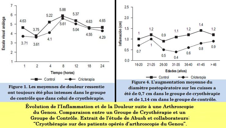 La Cryothrapie, une modalit efficace pour diminuer la Temprature Intra-articulaire, la Douleur et l'Inflammation suite  une Arthroscopie du Genou