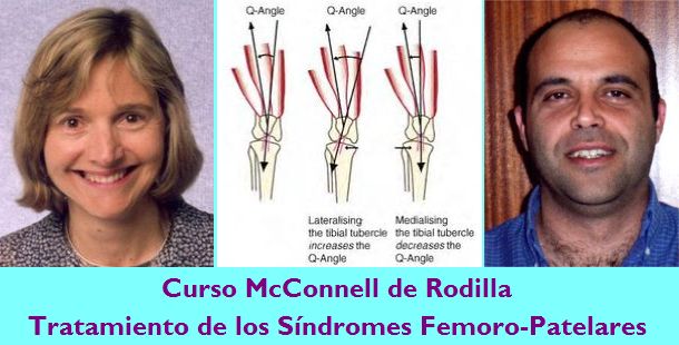 Este Fin de Semana tendrá lugar el Curso McConnell sobre el abordaje de los Síndromes Fémoro-Patelares en Bilbao