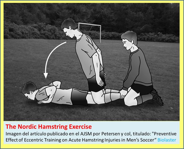 Prevencin de las Lesiones Musculares de Isquiotibiales en Futbolistas, mediante el Entrenamiento Excntrico