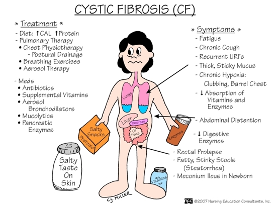 El Combinar un Entrenamiento de la Musculatura Inspiratoria con el Entrenamiento Fisico General Aporta Significativos Beneficios a los Nios con Fibrosis Quistica