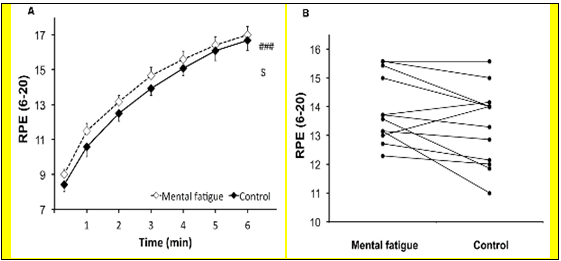 La fatiga mental no produce un aumento de la fatiga central durante un posterior ejercicio de resistencia
