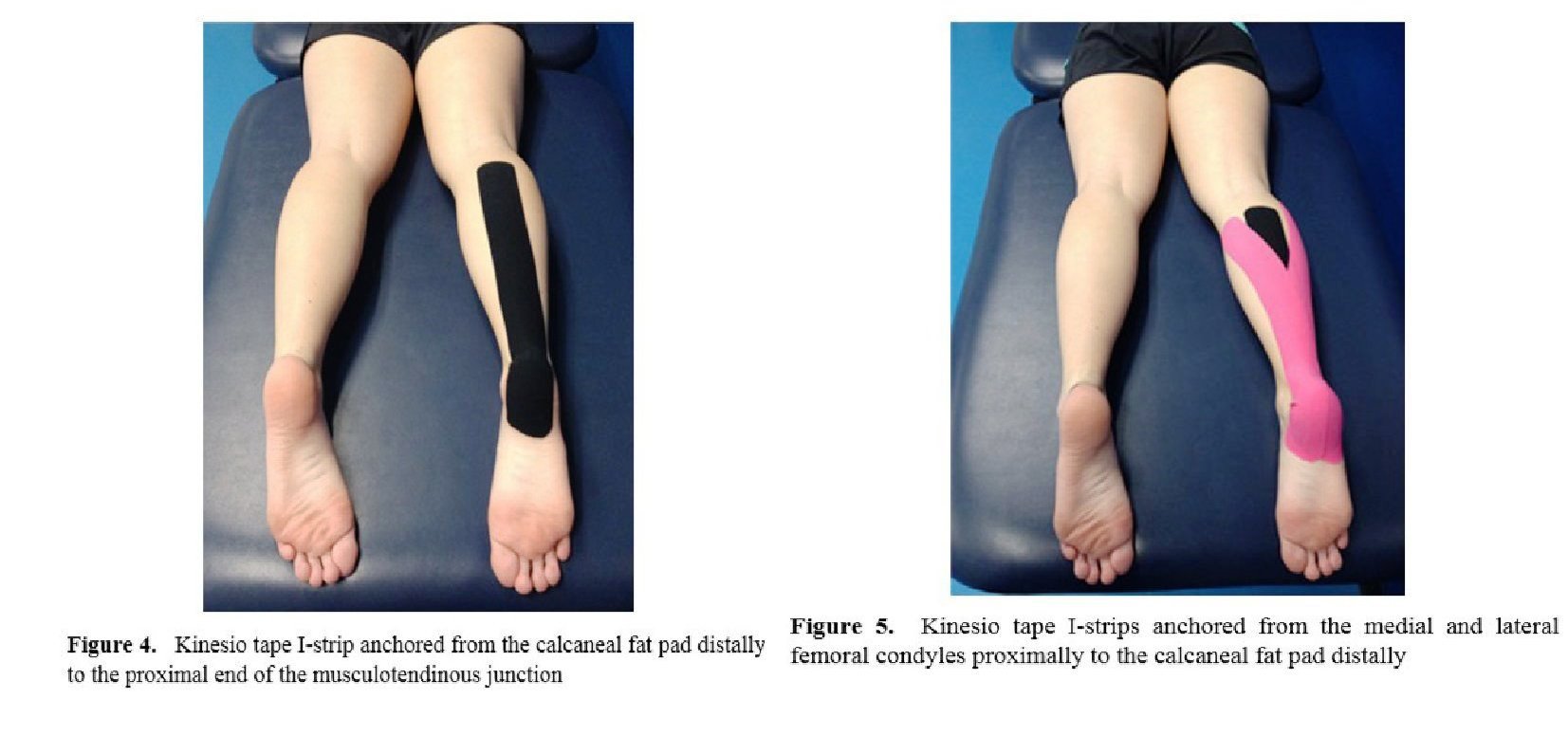Efecto del Kinesiotaping en la Altura del Salto Vertical y en la Actividad Electromiográfica de los Músculos Gastrocnemio y Sóleo en Atletas Universitarios