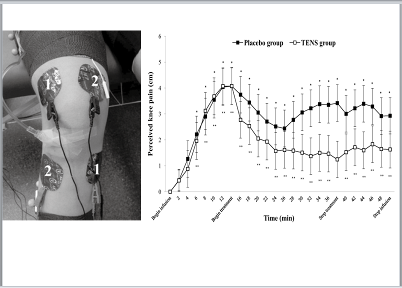 Inhibición de la Función del Cuádriceps por Dolor de Rodilla y aplicación de TENS