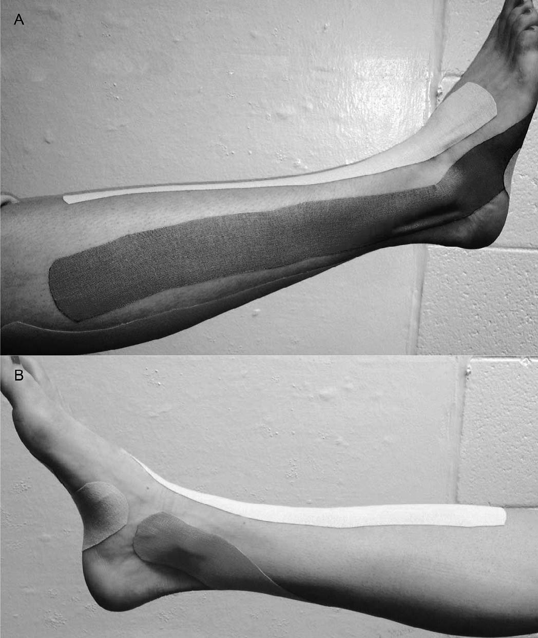 Uso de Kinesiotaping y Equilibrio en pacientes con inestabilidad crónica de tobillo