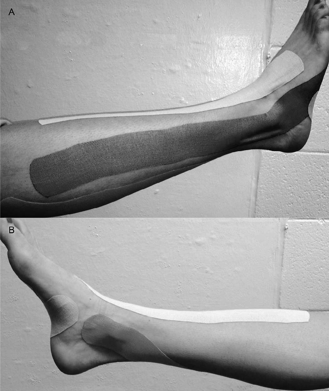 Uso de Kinesiotaping y Equilibrio en pacientes con inestabilidad crnica de tobillo