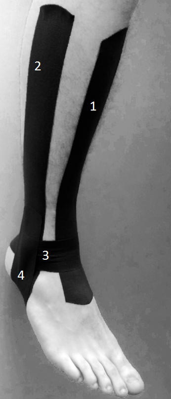 Influencia del Kinesiotaping en alta solicitación funcional mediante sprint eversión en jugadores de futbol sanos