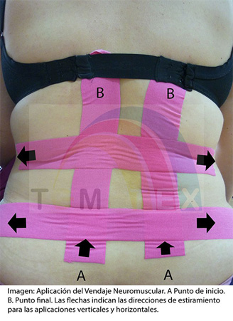 Resultados positivos de la aplicacion de vendaje neuromuscular en mujeres embarazadas