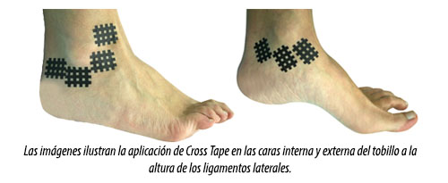 Aplicación de Cross Tape en el tobillo