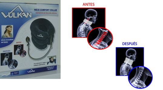 Viaje más cómodamente con el dispositivo de tracción cervical