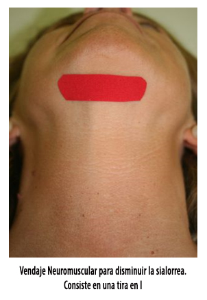 Aplicación del vendaje neuromuscular en el exceso de saliva o sialorrea