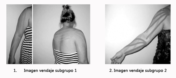 Kinesiotaping aplicado al linfedema de la extremidad superior en mujeres tras cirugía por cáncer de mama