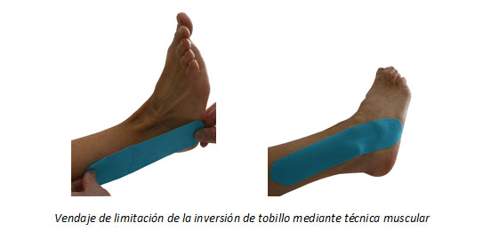 Utilizacion del vendaje neuromuscular en la inestabilidad del tobillo en atletas