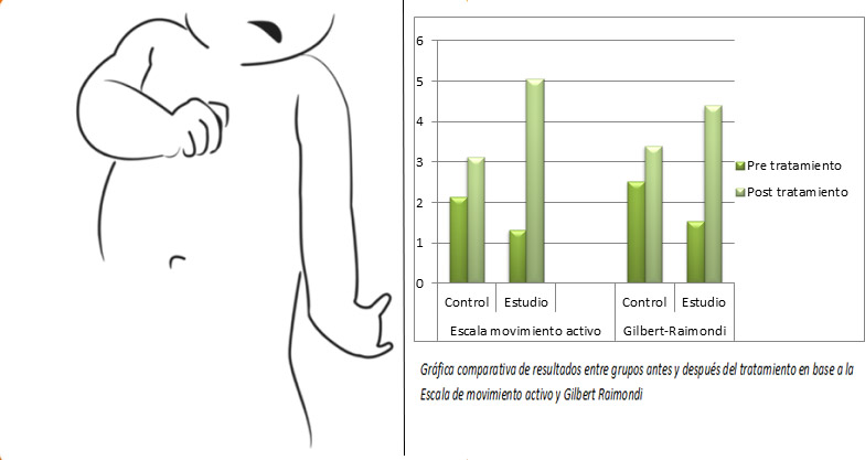 Aplicación del vendaje neuromuscular en la parálisis braquial obstetrica