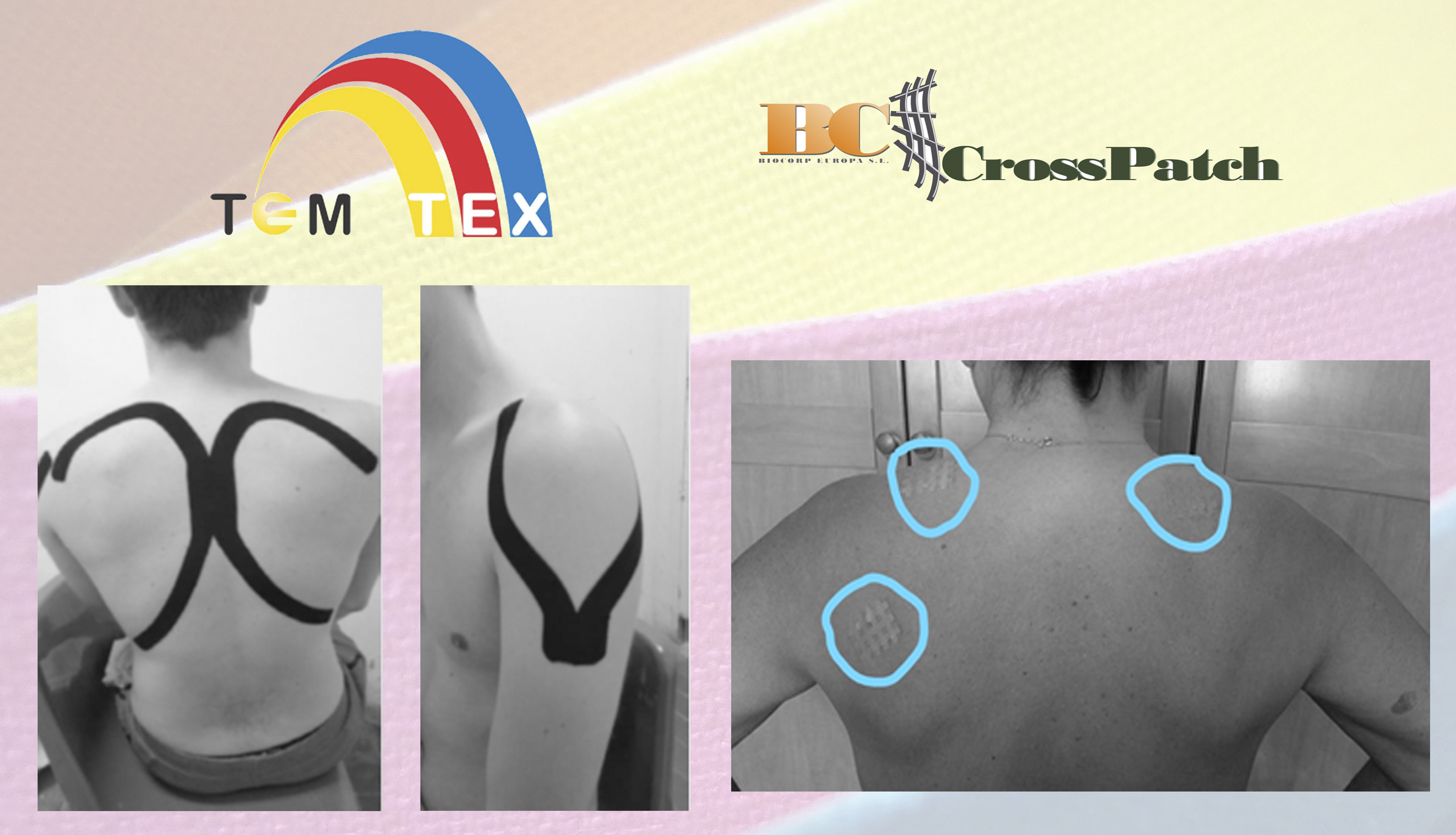 Kinesiotaping y Cross Tape aplicado al Tiro con Arco mejoran los resultados significativamente en un estudio reciente