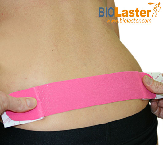 Efecto del Kinesiotaping para reducir las pérdidas de orina