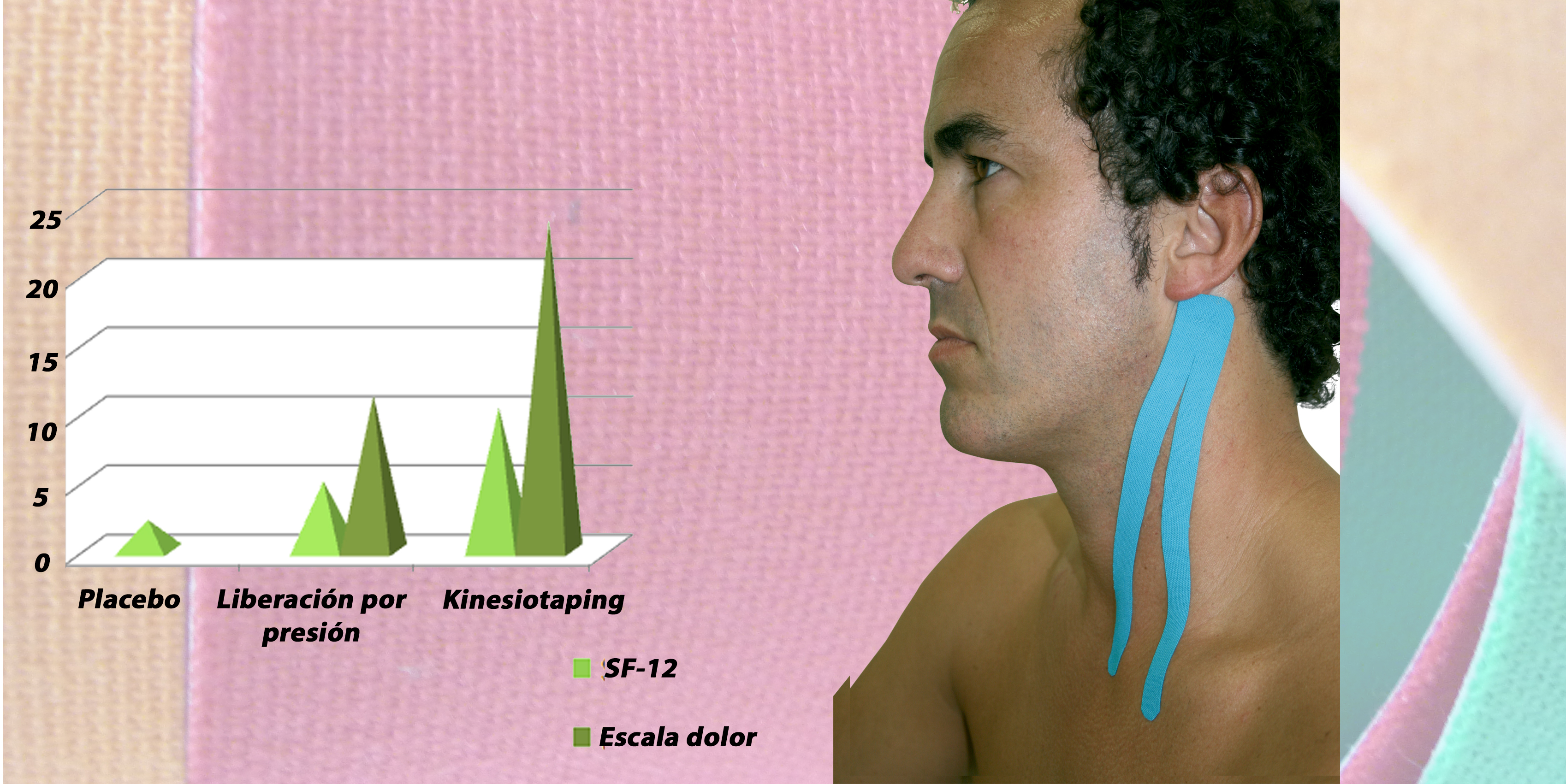Efectos del Kinesiotaping y de la Liberación por Presión en el dolor miofascial causado por el músculo ECM
