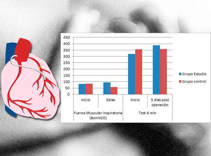 El entrenamiento de la musculatura inspiratoria mejora la recuperacin tras operacin de bypass coronario