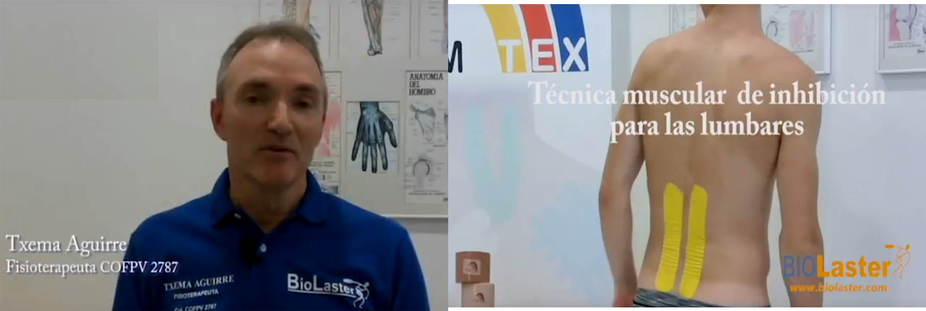 Técnica Muscular de Inhibición en las Lumbares