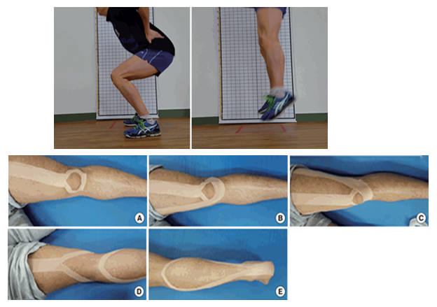 Accin del Kinesiotaping sobre el Rendimiento y la Fatiga en Jugadores de Voleibol.