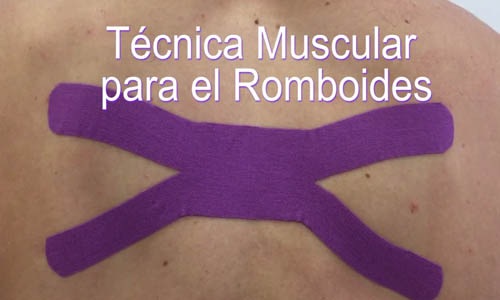 Vdeo: Aplicacin de Vendaje Neuromuscular para el Msculo Romboides