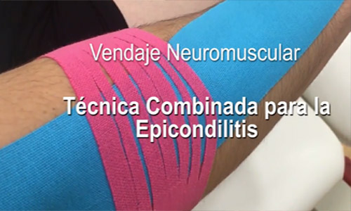 Tcnica de Vendaje Neuromsucular en video para la Epicondilitis