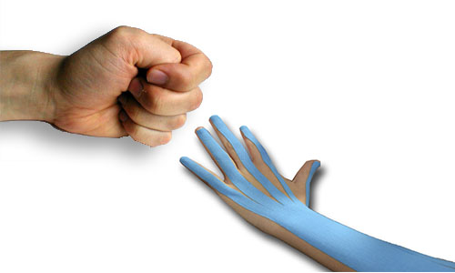 El Kinesiotaping  en el tratamiento de la hemiplejia