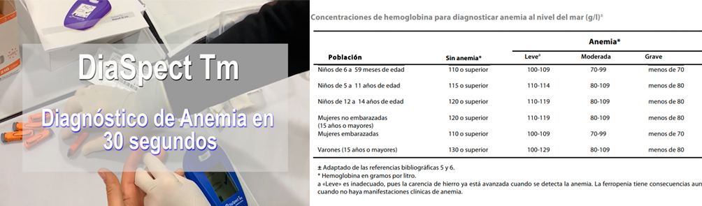 Una Gota de sangre y 2 segundos para diagnosticar la Anemia