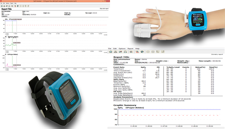 SPO2 Assistant – Monitorización de Pulsioximetría en Deporte, Salud y Montaña