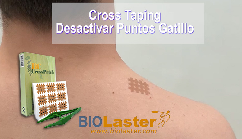 Video: Aplicacin BC Cross Tape para Desactivar Puntos Gatillo